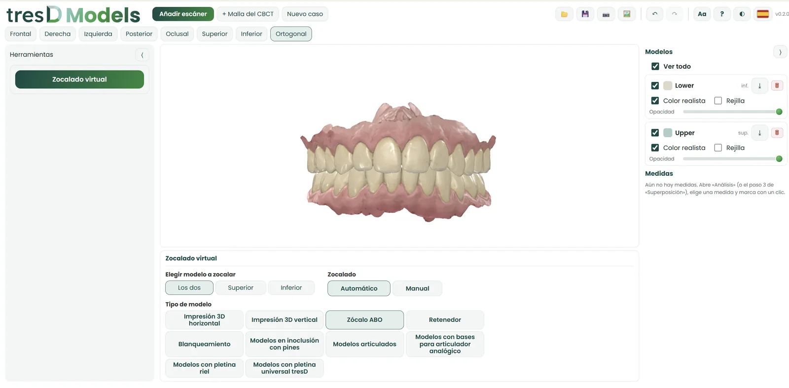 tresD Models interface with the virtual model base of two arches