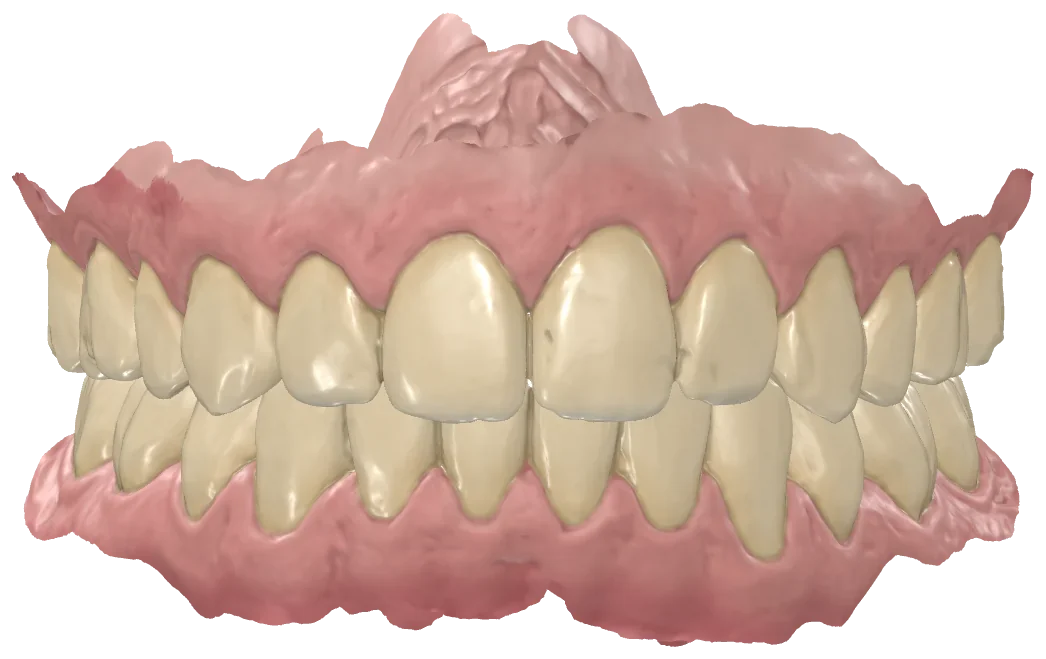 Upper and lower arches in realistic color