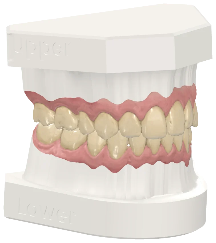 Models with ABO base and engraved labels